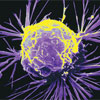 Вчені з’ясували, як ракові клітини обманюють імунну систему