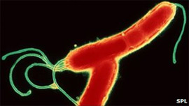 Хворобу Паркінсона викликає бактерія Helicobacter pylori? 