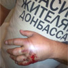 Громадянам України оголошено війну: у Києві підстрелили хлопця в футболці “Спасибо жителям Донбасса”