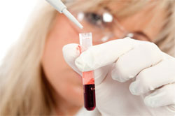 Вчені відкрили дві нові системи груп крові
