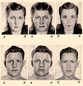 Антропологи давно звернули увагу на феномен асиметрії обличчя