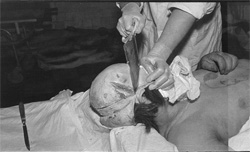 Енкаведістські лікарі готують черговий “матеріал” для вивчення(фото з ахіву НКВС)
